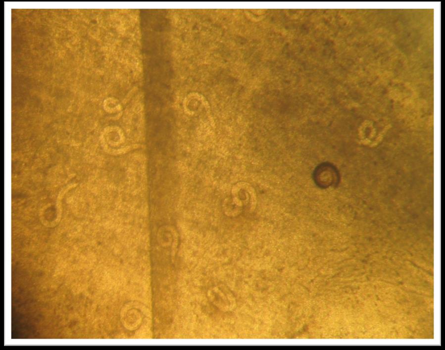 Protostrongylidae larvae from mollusks of Armenia (c)